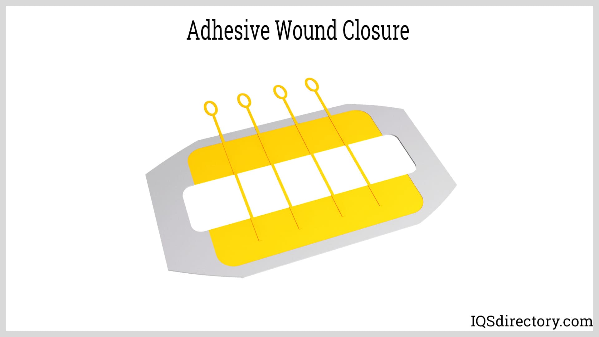 Adhesive Wound Closure